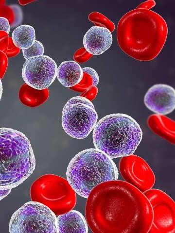 Leukemia cells Lymphoma cells