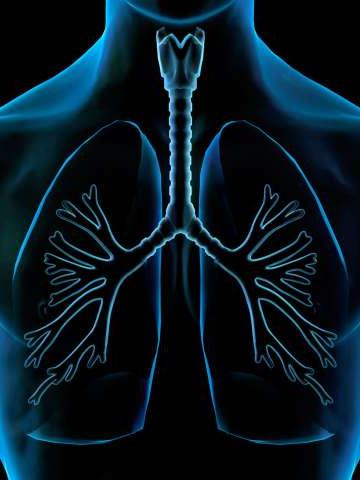 Lung Illustration, X-ray